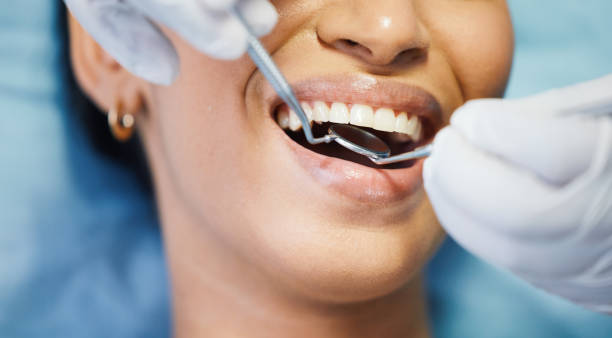 Best Emergency Tooth Extraction in Spencer, TN